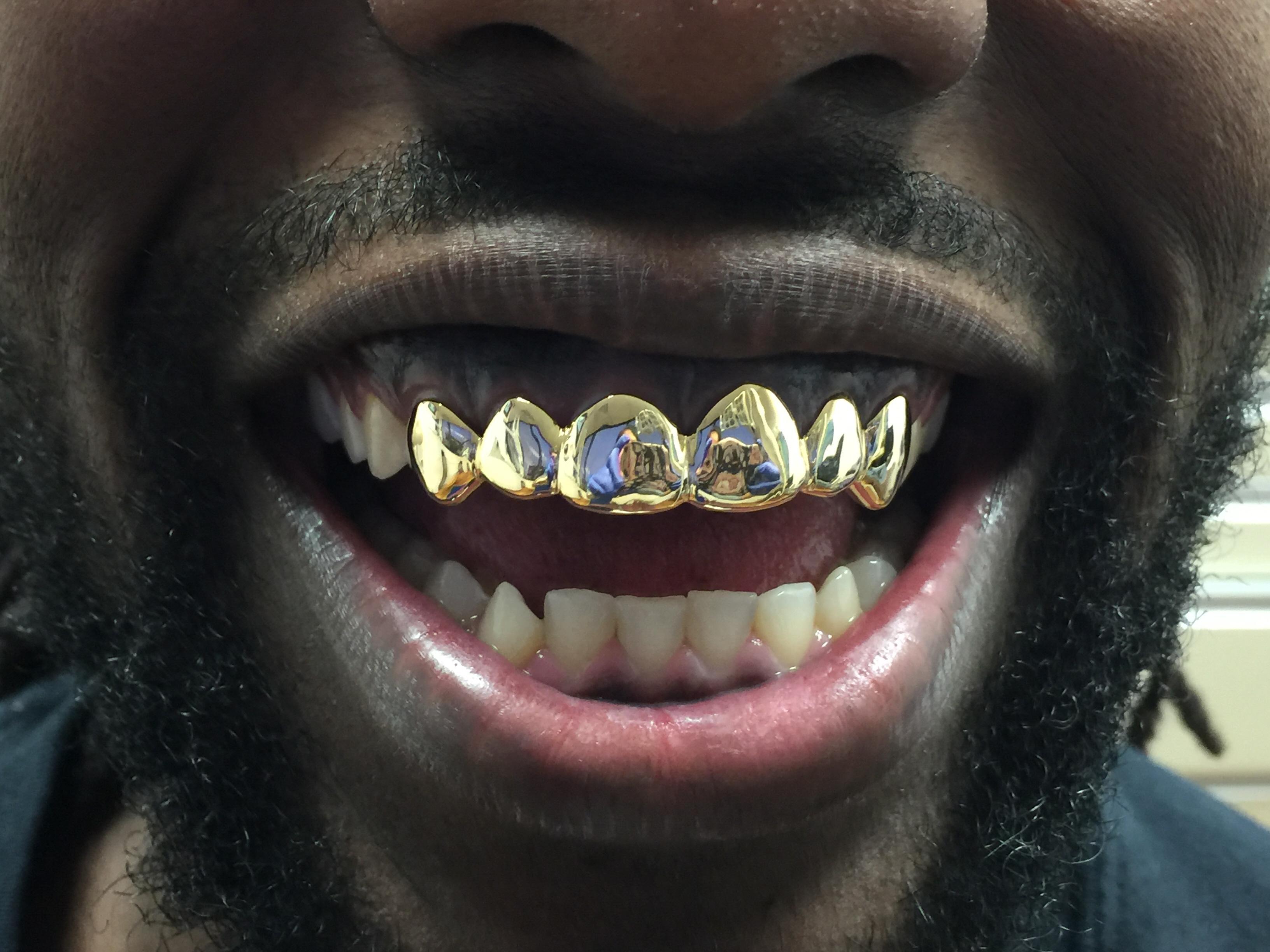 Chicago IL Dentist, Chicago Family Dentist, Dentist 60646 Grillz